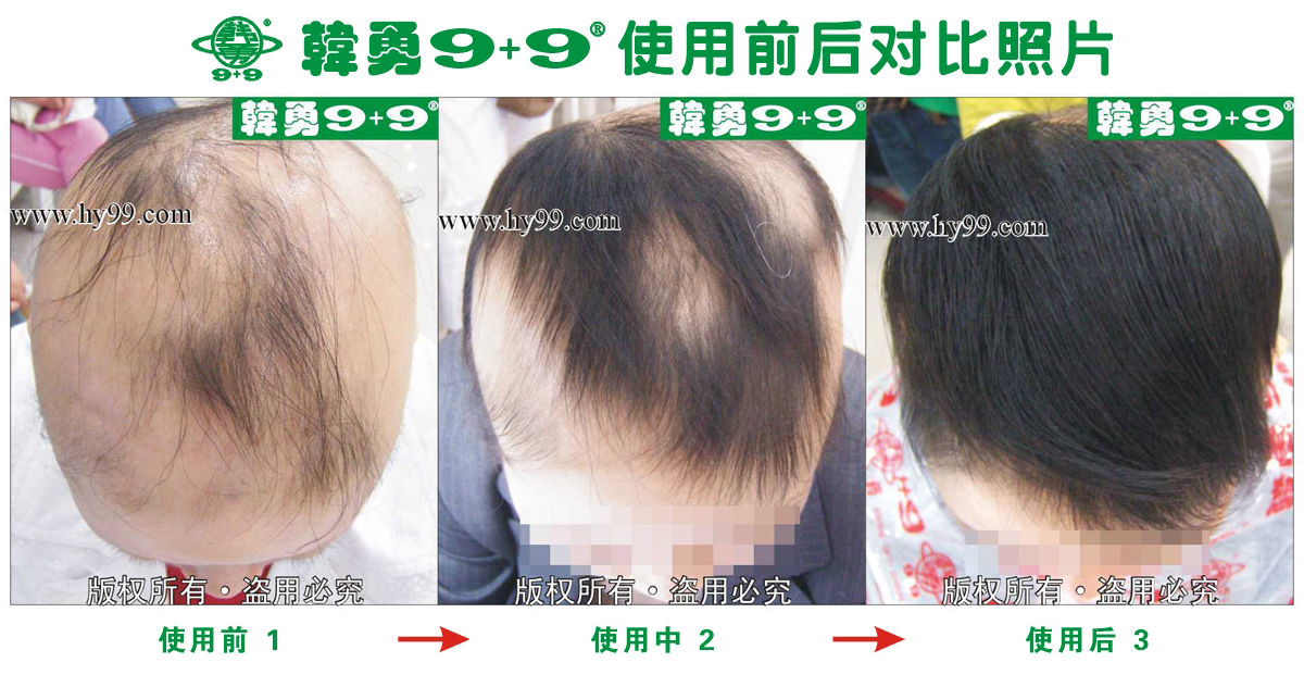 HD_bantu xa5-23(1).jpg