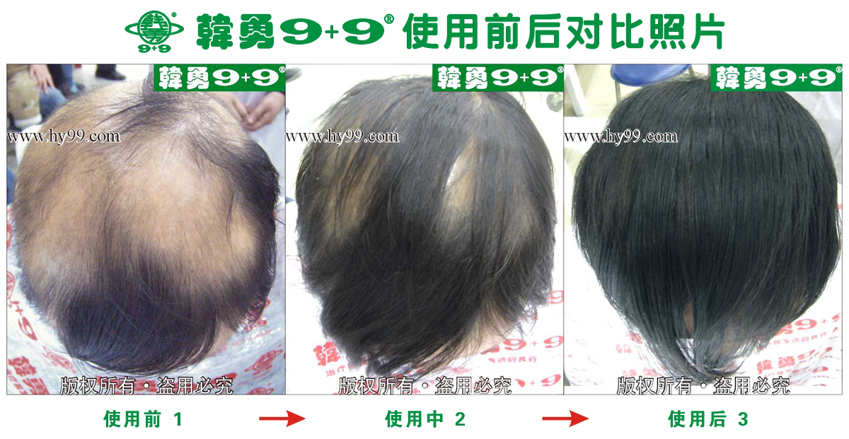 HD_bantu xa6-10(1).jpg