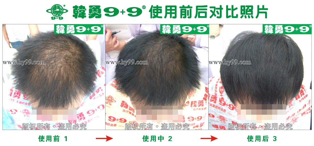 HD_zhiyixing bj111-66a.jpg