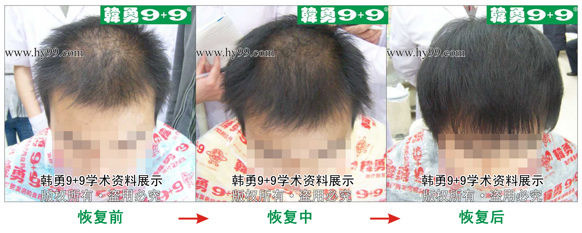 0004 HD_zhiyixing bj111-66b.jpg