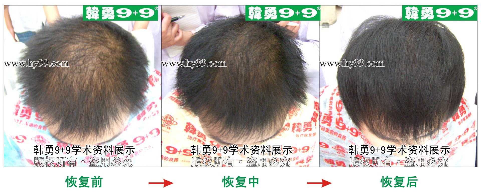 0004 HD_zhiyixing bj111-66a.jpg