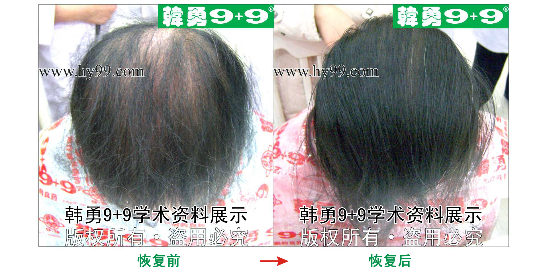 0008 HD_zhiyixing bj114-13a.jpg