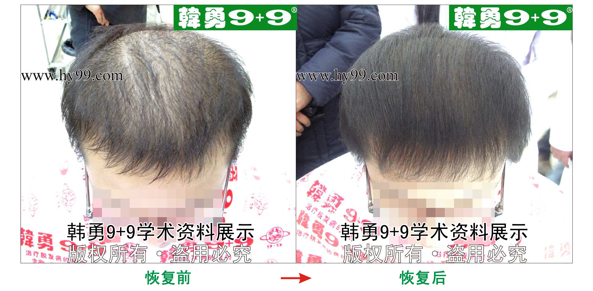 0014 HD_zhiyixing bj137-62b.jpg