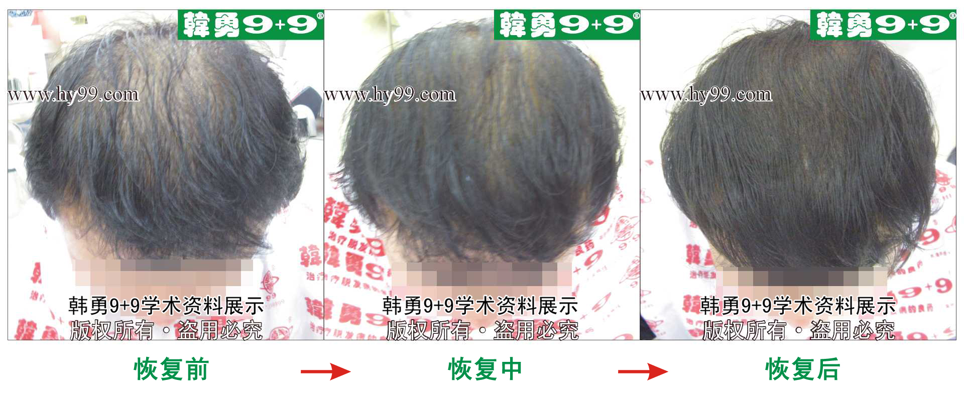 0016 HD_zhiyixing bj149-4a.jpg