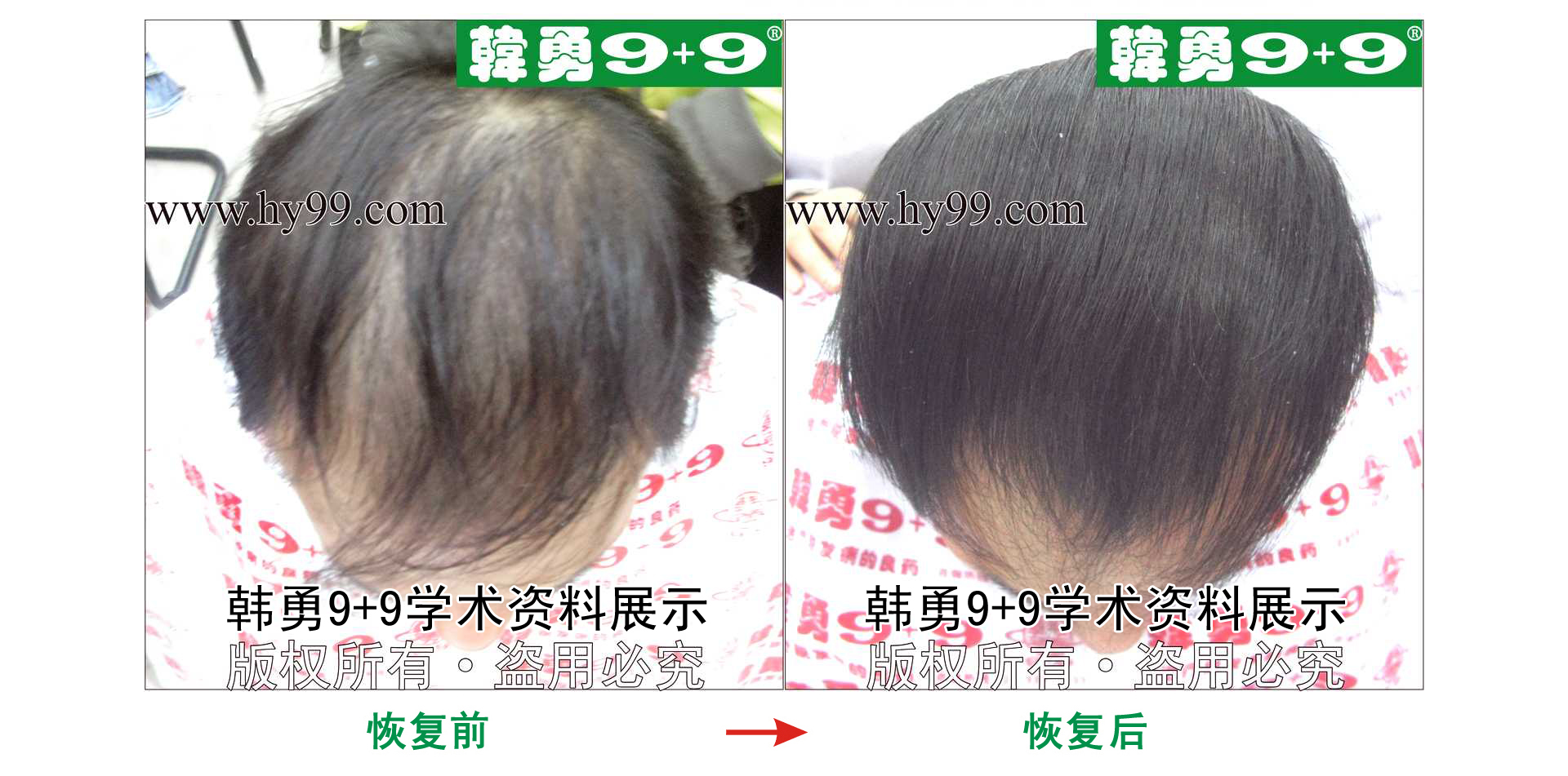 0022 HD_zhiyixing bj164-13a.jpg