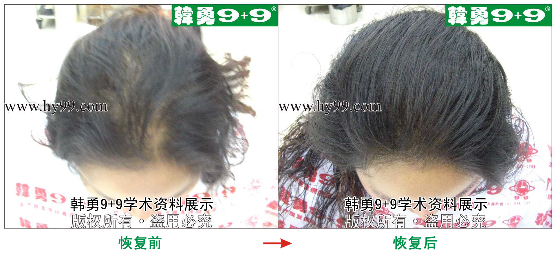 0030 HD_zhiyixing bj190-6c.jpg