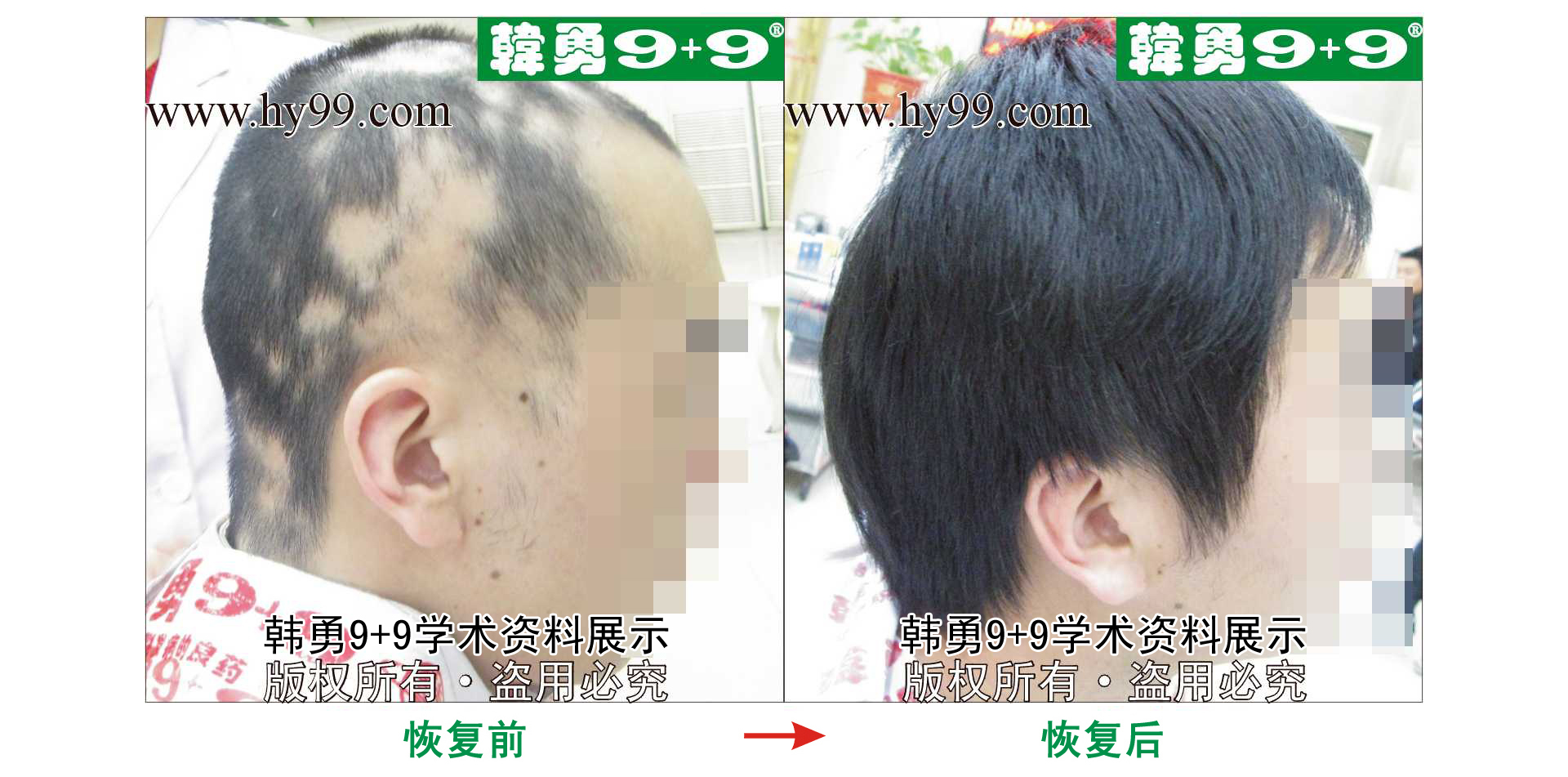 0031 HD_bantu bj143-68(2)b.jpg