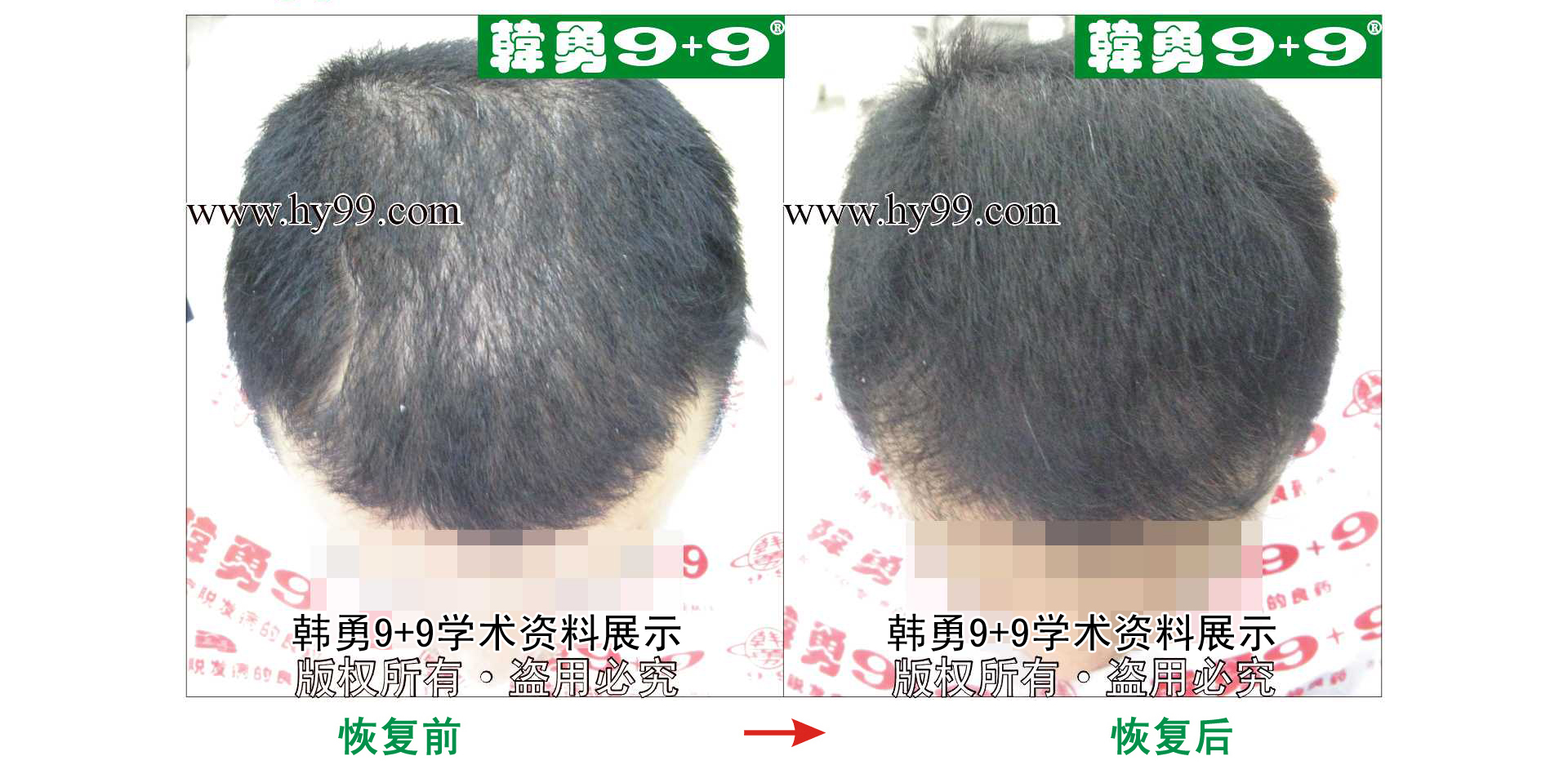 0039 HD_bantu bj145-33(1).jpg