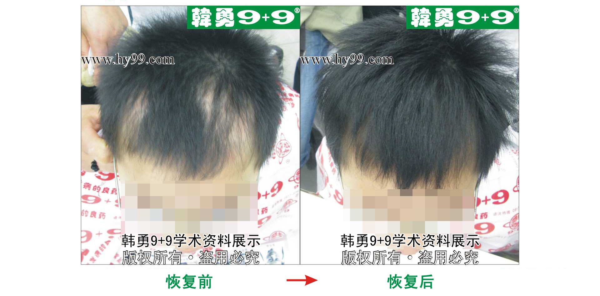 0049 HD_bantu bj155-28(1).jpg