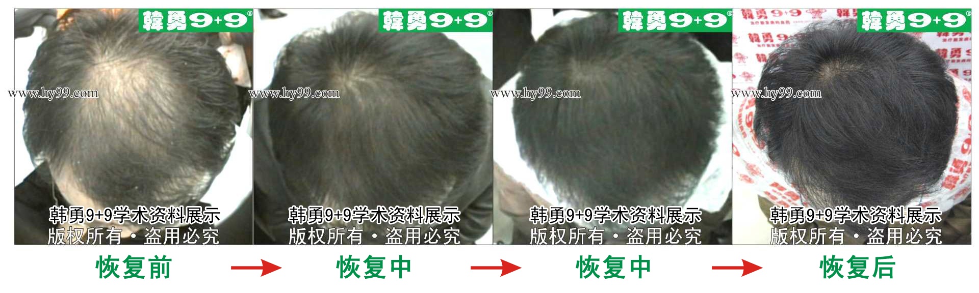 0050 HD_zhiyixing xa23-44.jpg